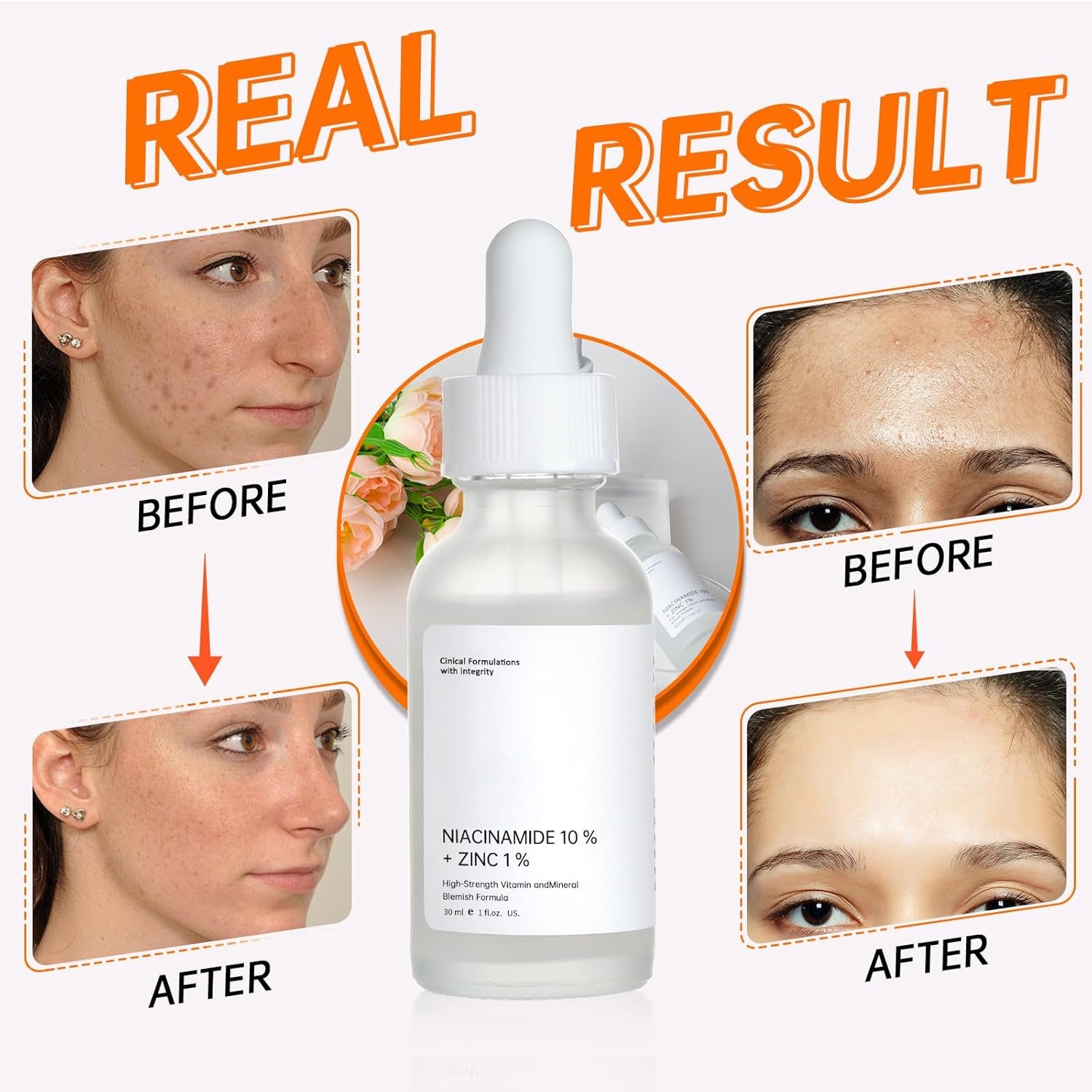 Anti-Aging Niacinamide Serum for Face,